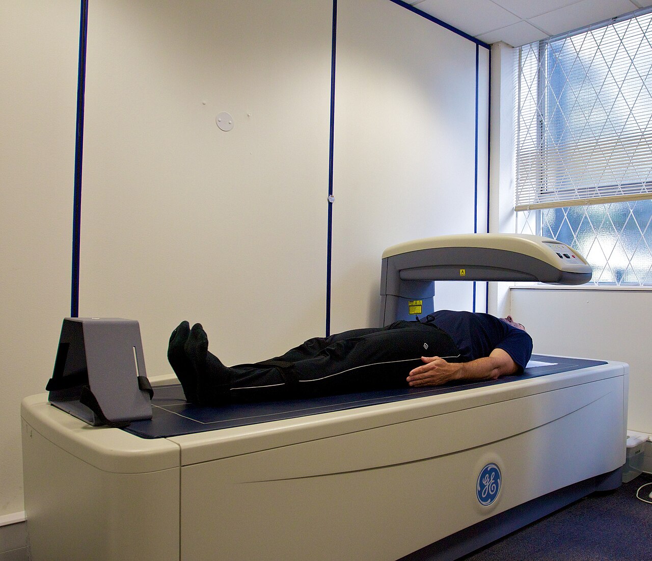 The Truth About Smart Scales vs. DEXA Scans: A 6-Month Experiment